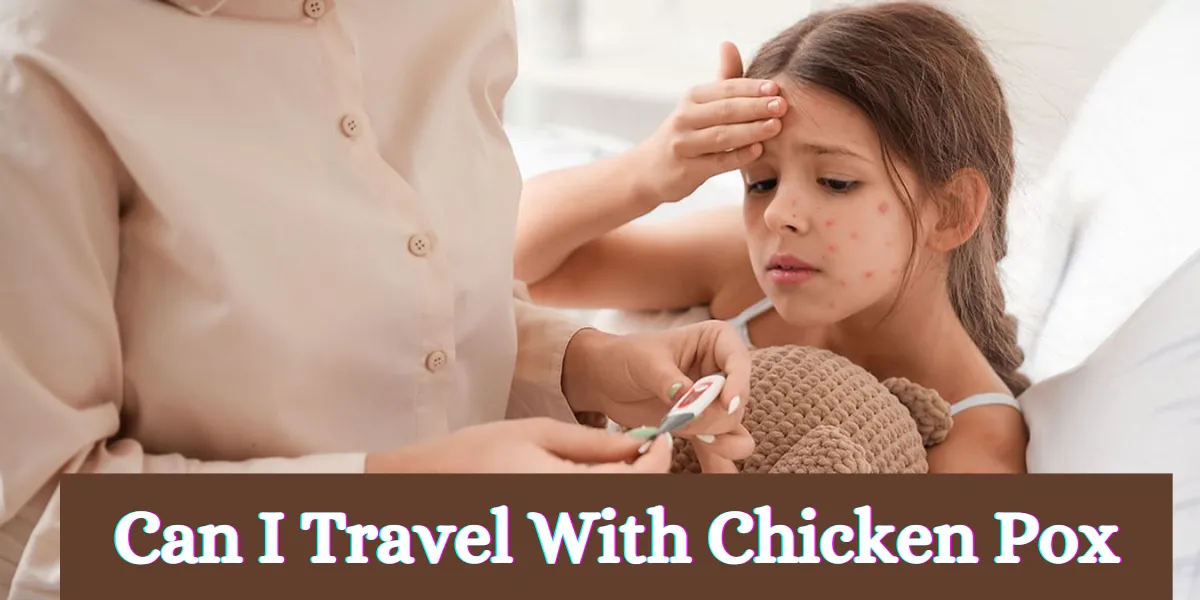 can i travel with chicken pox (1)